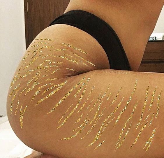 3 mejores prácticas en dermatología para reducir las estrías