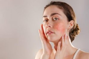 Dermatología